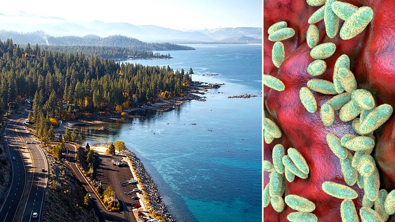 California resident tests positive for plague after likely infected flea bite